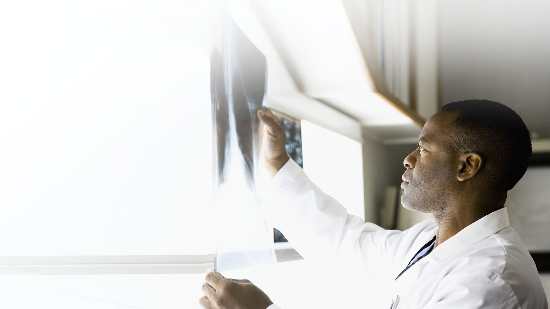 Young male physician looking at x-rays in a lightbox.
